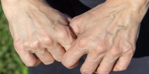 لن تصدق سبب ظهور عروق بعض الناس من الجلد.. مفاجأة