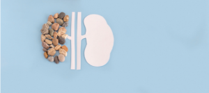 ما أسباب حصوات الكلى؟              وما أنواعها؟