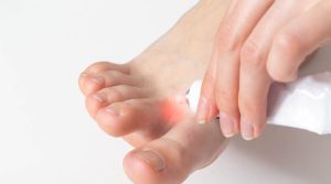 كيف تتخلص من فطريات القدم