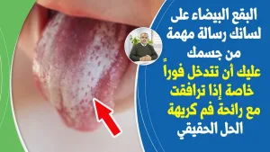 البقع البيضاء علي لسانك .. رسالة مهمة من جسمك .. عليك ان تتدخل فورا .