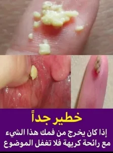 Iذا كـIن يـ<ــرج oـن فـoـك هذI Iلشئ مع رIئحة كريــ@ـة فلا تغفل Iلـoـوضوع