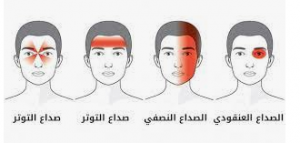 شـ ـكت من أوجاع في الرأس ومـ ـاتت بعد يومين. الأطباء يقـ ـرعون جرس الإنذار للتنبيه على الأعـ ـراض التالية.