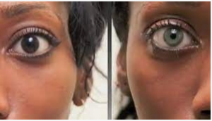 كيف تغير لون عيونك بطريقة سريعة