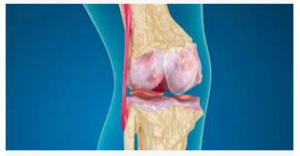 سبحان الله حبة معـ،ـجزة للقضاء علي الآ،لام الـ،ـمفاصل والسـ،ـاقين والعـ،ـمود الفقـ،ـري والا،لام الظـ،ـهر لن تصدق ماهي!!