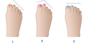 أعرف أصلك من أصابع قدميك