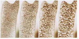 تحذير تناوله يوميا يدمـ،ـ,ـر الدمـ،,،ـاغ ويقضـ،ـي على الذاكره ويصيبك بهـ،,ـشاشة العظام