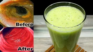 كوب تنظـ،ـيف القولون ستخرج منك فضلات صلـ،ـبة كالأحجار لم تخرج من سنين وستخف بطنك بشكل كبير.