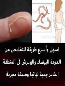 وصفة سهلة تخلصك تماماً من الدودة البيضاء