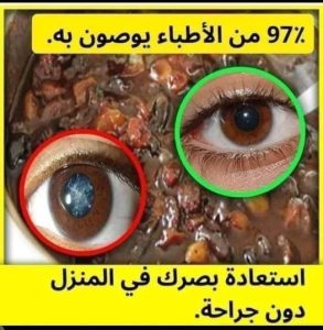 معجزة.. علاج ضعف النظر وتقويه شبكة العين اقوي وصفة للتقوية في اسبوعين وبفضل الله سوف تسترجع قوة البصر