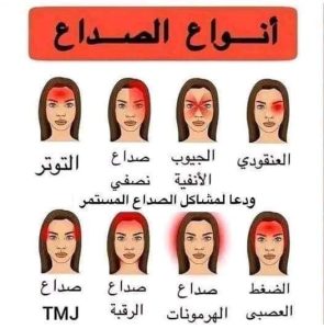 أسباب الصداع