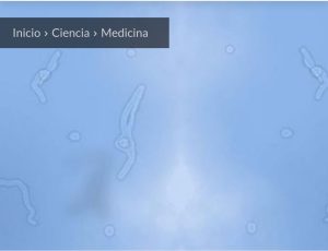 Miodesopsias o cuerpos flotantes: que son y cómo debes tratarlos