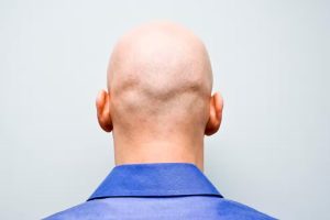 مفـ،ـاجـ،ـأة.. الرجل الأصـ،ـلـ،ـع سيولد الكهرباء من خلال ”صلعته” قريباً