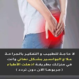 شاهــ،دوا طريقة إزالـ،ـة البواسـ،ـير بدون جـ،ـراحة وفي 3 ايام ستخــ،ـتفي البواسـ،ــير