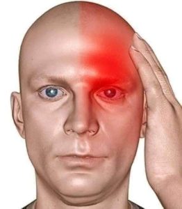 الصـ،ـ،ـداع أو الشـ،ـقـ،ـيـ،ـقة أو migraine