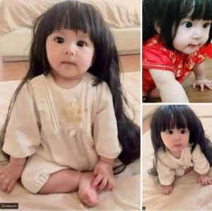 رفـ،ـضـ،ـت الام قرار الاطباء باجـ،ـهـ،ـ،ـاض طفلتها بالشهر الخامس بعد اكـ،ـتـ،ـشـ،ـاف كورة سوداء بالسونار واكـ،ـتـ،ـشـ،ـفـ،ـوا بعد الولاده صد , مة