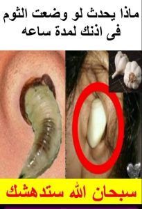 ماذا يحدث عندما تضع الثوم في اذنك .. روائع