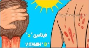 فوائـ.ـ.ـد فيتاميـ.ـ.ـن د