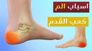 اسباب الـ،ـم كعب القدم