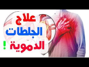 6 علامات تظهر على الجسم تكون دليلا على وجود جلـ،ـطة د مـ،ـوية فى الجـ،ـسم