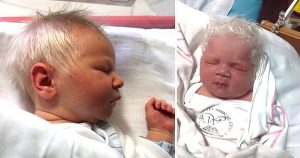 Boy born with snow-white hair surprises doctors until they realize the truth.