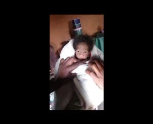 Doctors laughed when he was born – but soon realized his condition was more serious