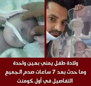 اول مولود بعين واحده