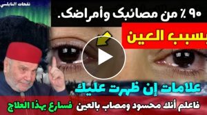 علامات ان ظهرت عليك فاعلم انك محسود ومصـ‌‌اب بالعين فسارع بفعل هذا