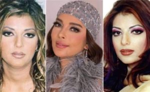 5 عمليات تجميل وراء ظهور أصالة بشكل مختلف مرتين في شهر واحد