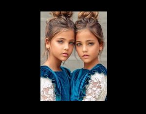 12 Years Ago They Were Called The World’s Most Beautiful Twins – Now Look At Them