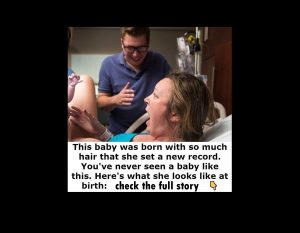 This baby was born with so much hair that it was visible on the x-ray taken of her while she was still in her mother’s womb.