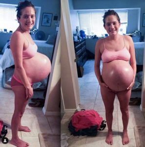 Her pregnant belly won't stop growing -when doctors look inside, they freeze..