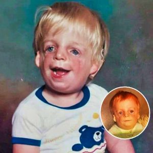 When Jono's mother first saw his face, she ran away and left him in the maternity crib. You won't believe what this ”monster” looks like today!