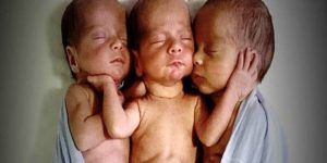 The mother rushes to the hospital to give birth to triplets. Then the doctors look more closely and can’t believe