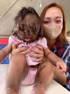 شاهد كيف أصبحت الطفلة الذئب في أول ظهور لها في 14 سنة.. لن تتوقع كيف أصبحت