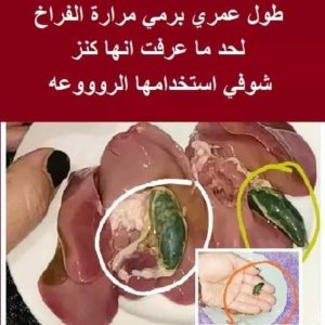 طول عمري برمي مرارة الفراخ لحد ما عرفت انها كنز شوفي استخدامها الروووعه الليدي لومه