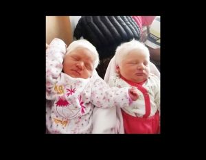 Rare albino twins with snow-white hair took the world by storm & made headlines – see how they look today