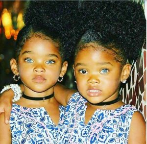The ‘Blue Twins’ made headlines thanks to their amazing eyes – and this is how they look today