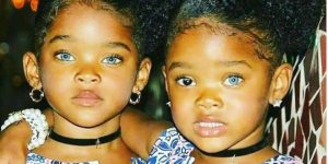 The ‘Blue Twins’ made headlines thanks to their amazing eyes – and this is how they look today