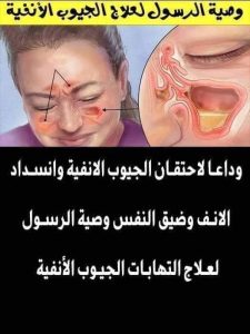 وصــ،ــية الرسول لعـ،ــلاج الجيوب الانفيه