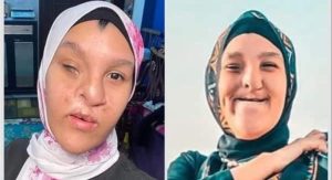 اليوتيوبر إسراء أحمد تنشر أول صورة لها بعد إجراء عملية تجميلية.. معلقة: بصوا عاوزاكم تنبهروا