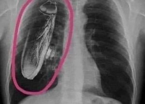 قصة طريفة في عالم الطب