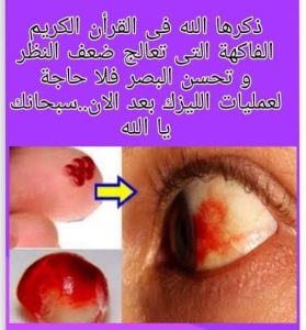 فاكهة لعلاج النظر