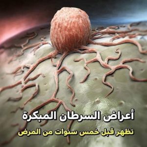 أعـراض السـرطان التي تظهر قبل خمس سنوات من المـرض