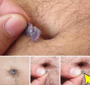 لن تصدق لماذا يتكون قطن في سرة البطن ؟ سر لا يعلمة احد ابدا