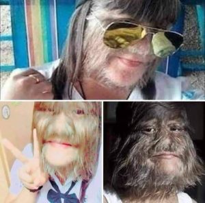 أكثر فتاة مشعـ,,ـرة بالعالم تحلق شعرها للزواج!.. شاهد التحول الصادم بعد الحــلاقة