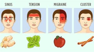 حالات الصداع علي حسب التشخيص والاعراض