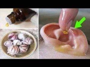 ثلاث قطرات في الأذن بالليل  والنتيجة سوف تبهرك استرجاع السمع بنسبة 90٪  علاج ضعف السمع بمكونين فقط