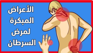 احذر اعراض السرطان