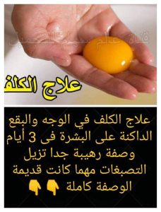 علاج الكلف