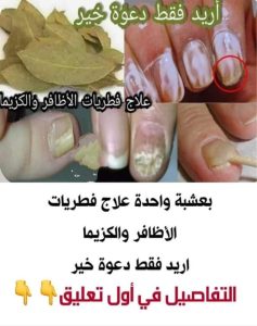 فطريات الأظافر